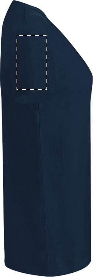 Right sleeve