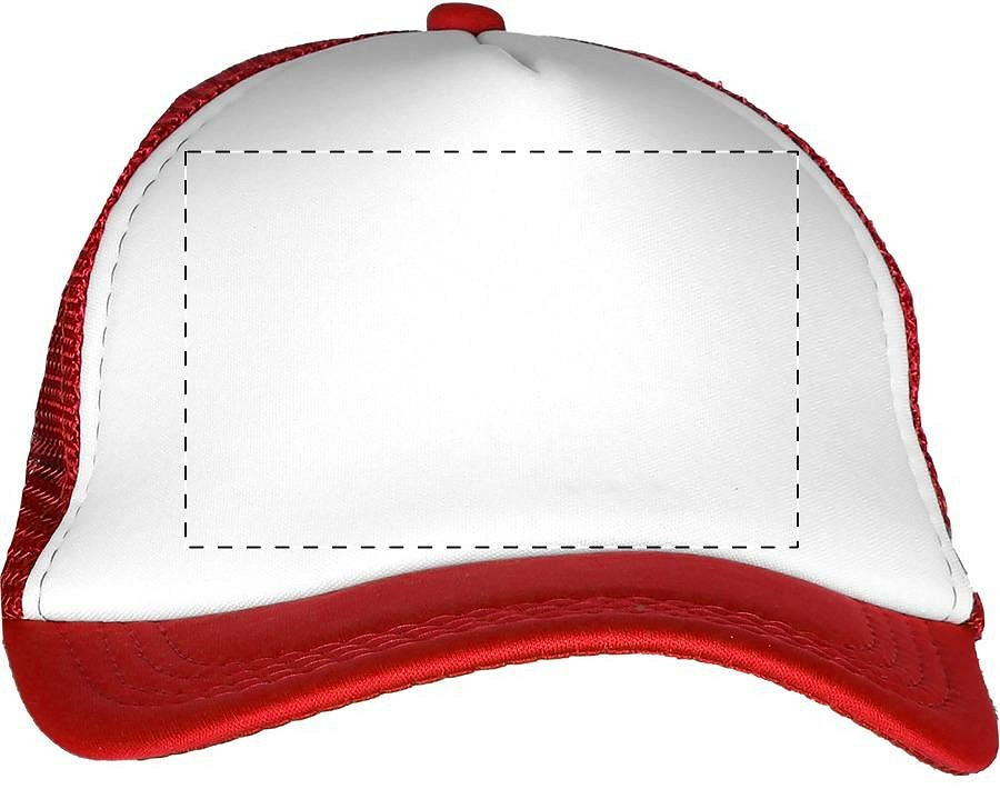 Front side