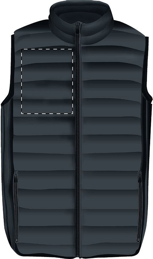 Right chest