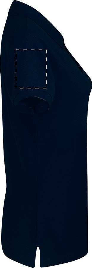 Right sleeve